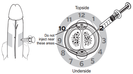 Figure 3. Choosing an injection site