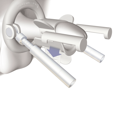 PeniMaster® Classic - Physiological Penis Expander - Image 11