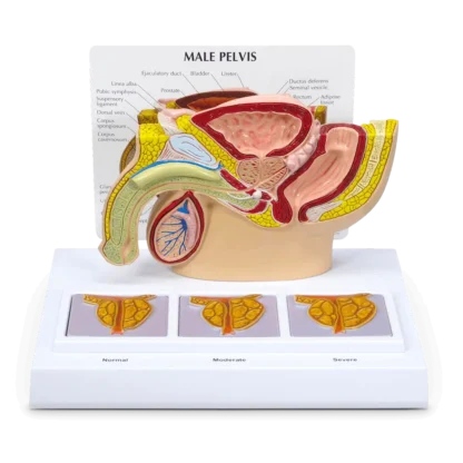 Anatomical Male Pelvis and Prostate Model | The Prostate | Mens Health Downunder