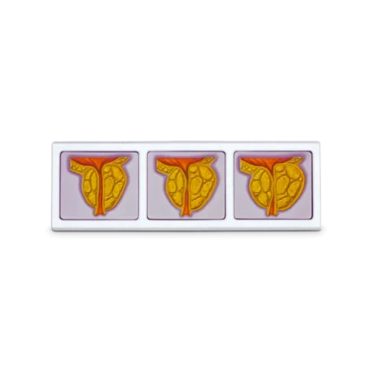 Anatomical Male Pelvis and Prostate Model | The Prostate | Mens Health Downunder