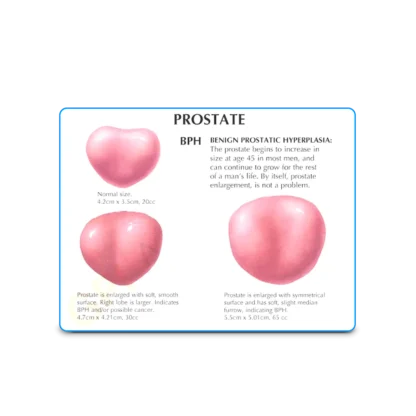 Anatomical Male Pelvis and Prostate Model | The Prostate | Mens Health Downunder